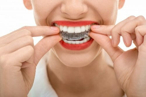 woman with invisalign